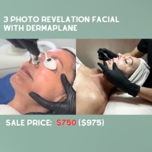 PACKAGE 6- 3 Photo Revelation Treatments with Dermaplane