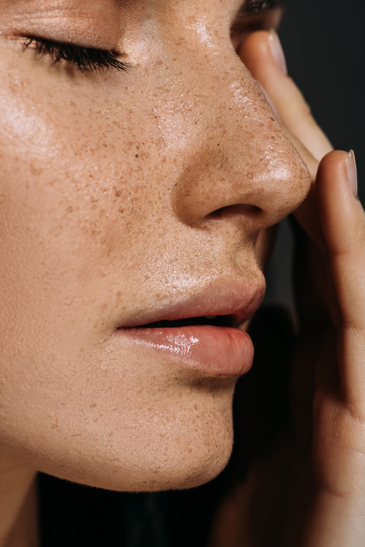 woman with freckles touching her face
