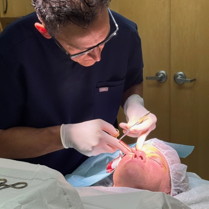 doctor aker performing facial surgery doctor aker performing facial surgery
